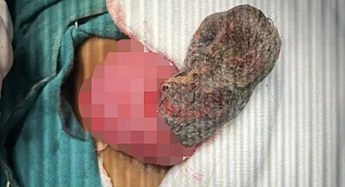 4 Yaşındaki Kız Çocuğunun Midesinden Çıkanlar Şaşırttı!