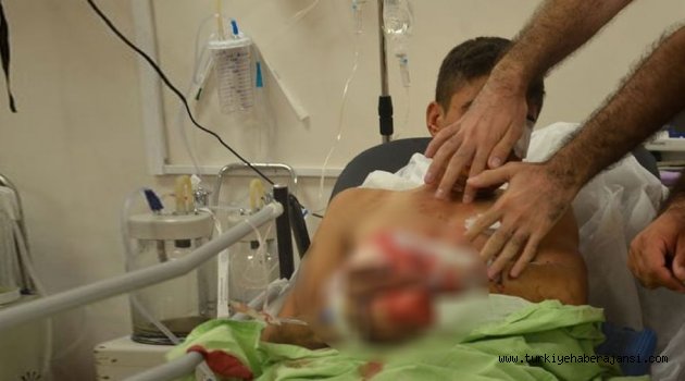 Bomba Teröristin Elinde Patladı