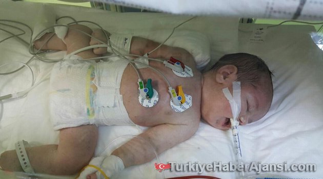 Ebenin Geri İttiği Bebek 76 Gün Dayanabildi