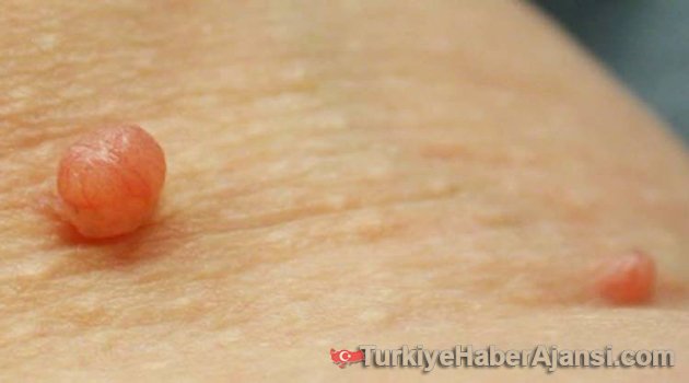 Et Beni Neden Çıkar?