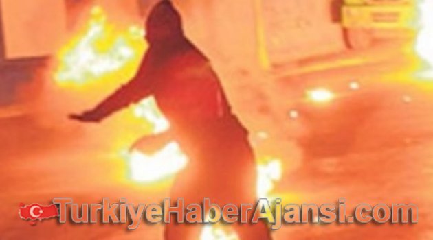 Polise Atmak İstedi Elinde Patladı