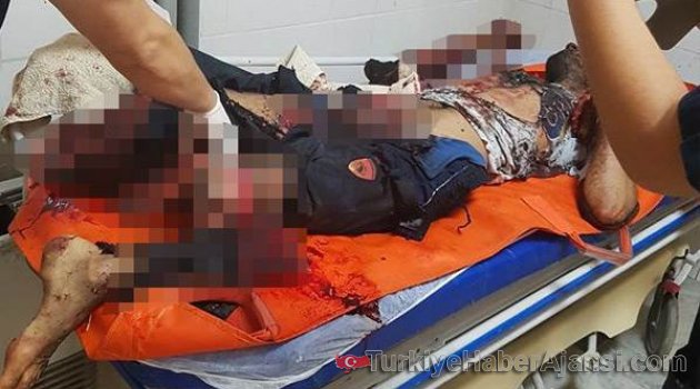Suriyeliler Bomba İmal Ederken Ellerinde Patladı