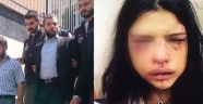 Onur Özbizerdik'in Sevgilisi Bulundu