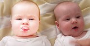 Vietnamlı İkizlerin Babaları Farklı Çıktı